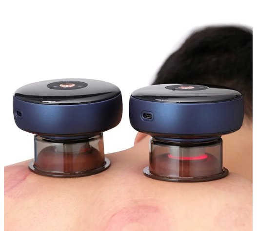 Electric Cupping Massager